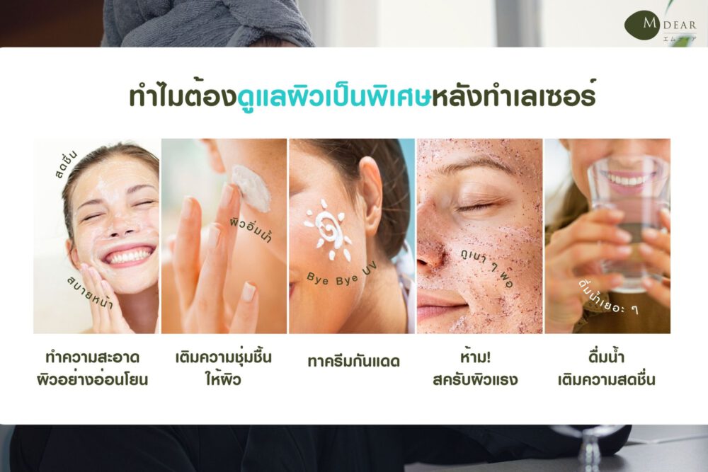 How to ดูแลผิวหลังเลเซอร์ Jcomfy Thailand