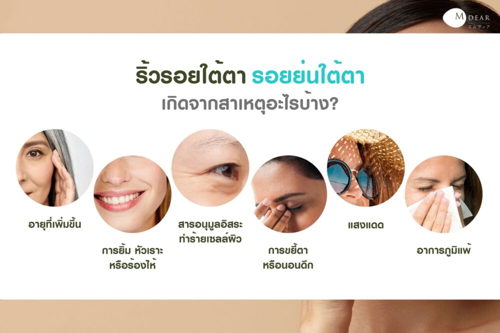 รอยย่นใต้ตา Perfect Eye Cream LF Jcofy Mdear Thailand